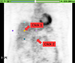 Place ROI around liver