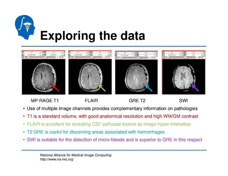 File:TBISegmentation tutorial.pdf