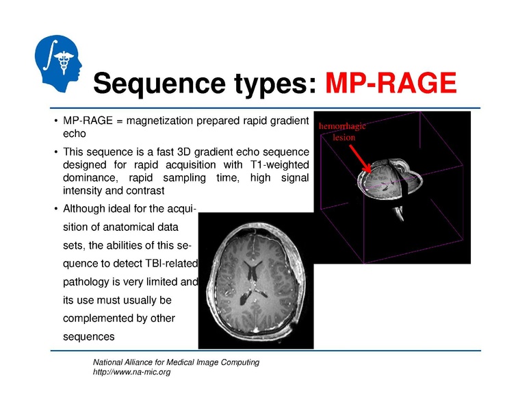 File:TBISegmentation tutorial.pdf