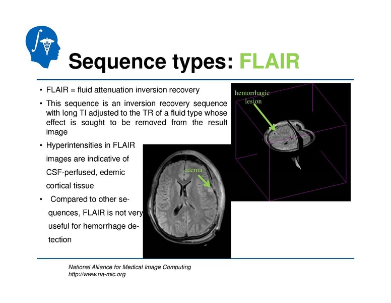 File:TBISegmentation tutorial.pdf