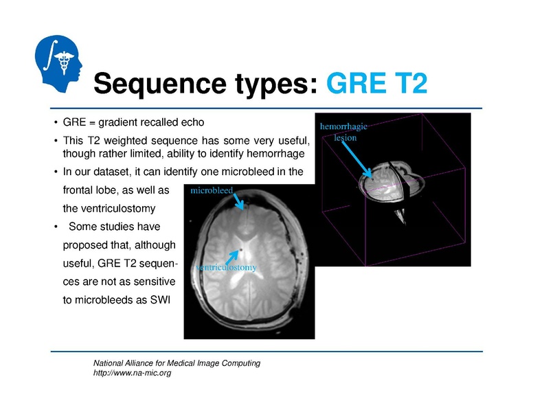File:TBISegmentation tutorial.pdf