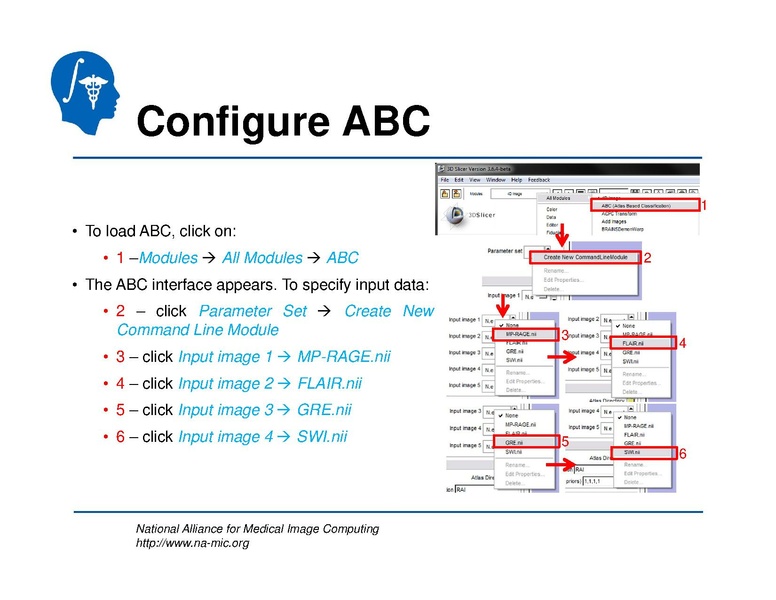File:TBISegmentation tutorial.pdf