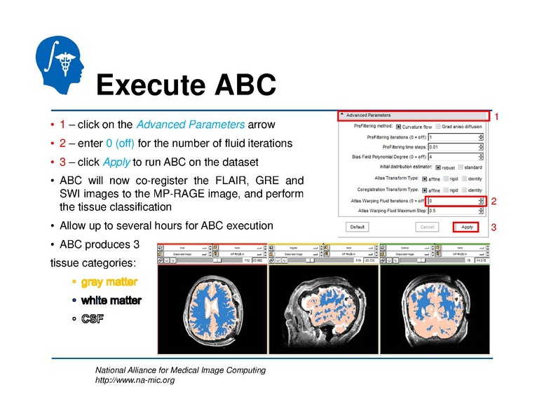 File:TBISegmentation tutorial.pdf