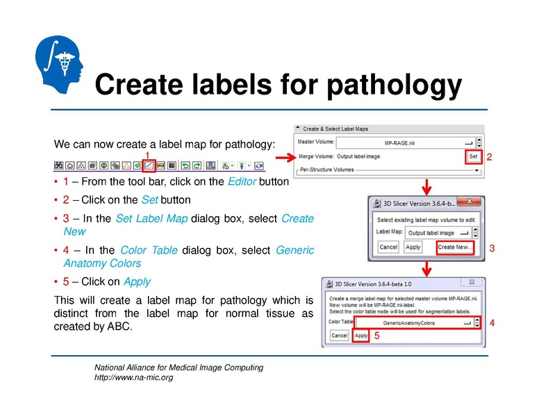 File:TBISegmentation tutorial.pdf