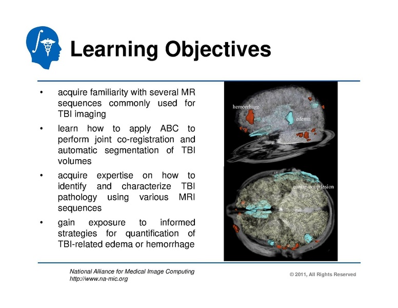 File:TBISegmentation tutorial.pdf