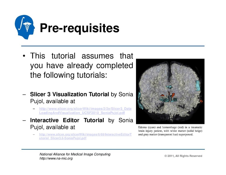 File:TBISegmentation tutorial.pdf