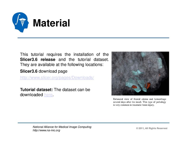 File:TBISegmentation tutorial.pdf