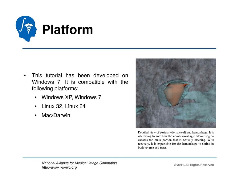 File:TBISegmentation tutorial.pdf