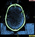 Thumbnail for version as of 13:44, 4 May 2011