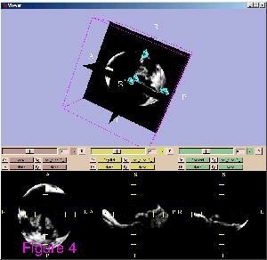 File:VerheyBioMedEngOnline2006.pdf