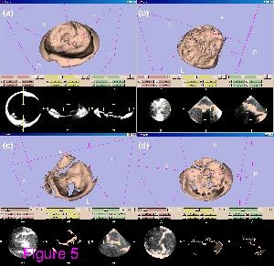 File:VerheyBioMedEngOnline2006.pdf