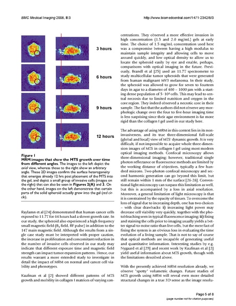 File:Huang-BMCMedImaging2008.pdf
