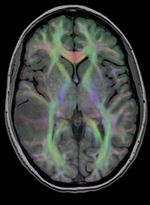 RegLib C29 Thumb.png