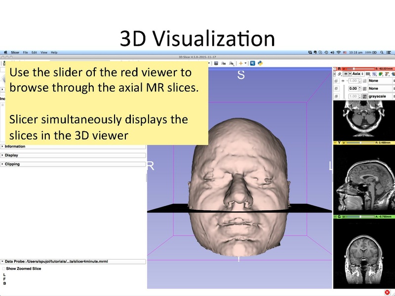 File:Slicer4.5minute SoniaPujol.pdf