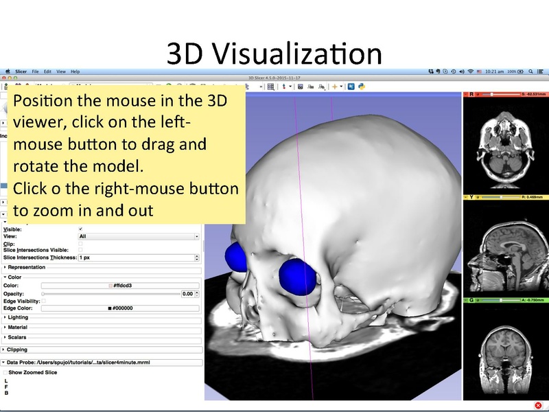 File:Slicer4.5minute SoniaPujol.pdf
