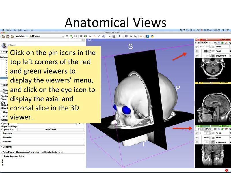 File:Slicer4.5minute SoniaPujol.pdf