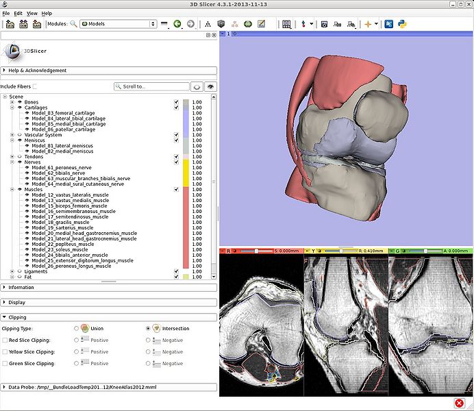 File:Slicer43-Models-KneeAtlas.jpeg