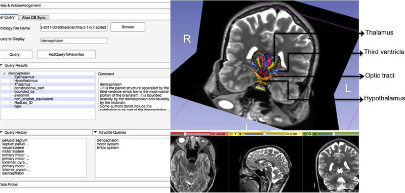 File:Veeraraghavan-Neuroinformatics2014-fig6.png