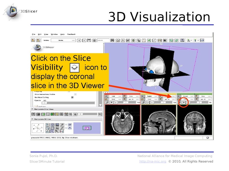 File:Slicer3.6MinuteTutorial SoniaPujol.pdf