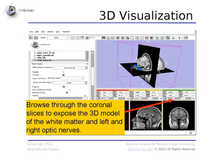 File:Slicer3.6MinuteTutorial SoniaPujol.pdf