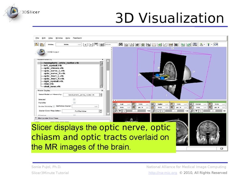 File:Slicer3.6MinuteTutorial SoniaPujol.pdf