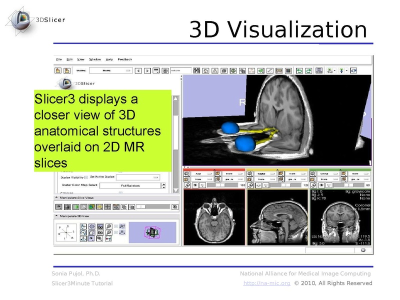 File:Slicer3.6MinuteTutorial SoniaPujol.pdf