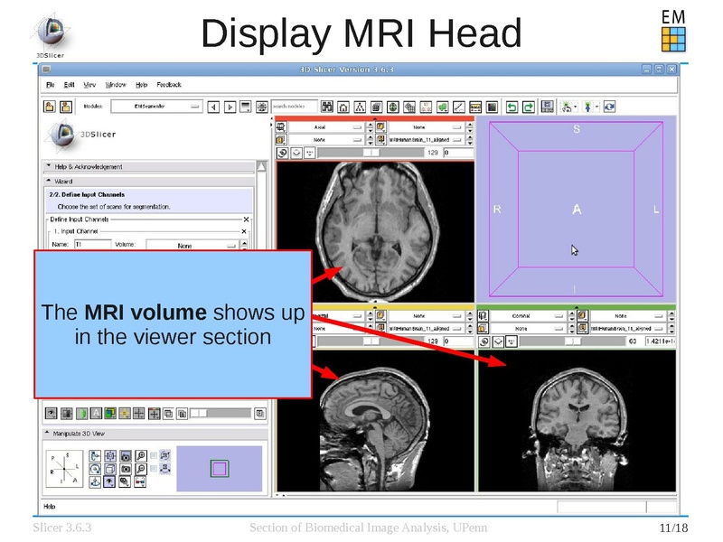 File:EMSegmenterTutorialSimpleMode-Slicer-3.6.3-1.pdf