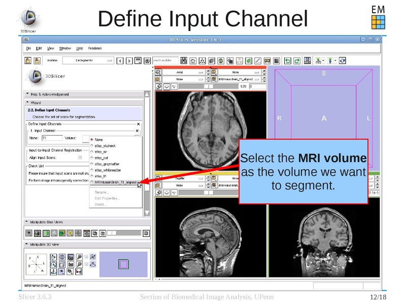 File:EMSegmenterTutorialSimpleMode-Slicer-3.6.3-1.pdf