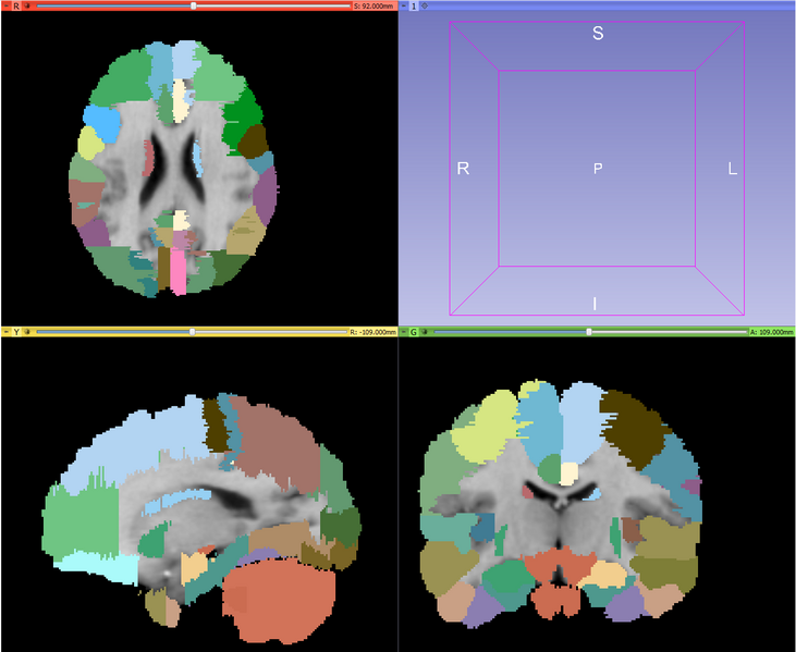 File:MABMIS groundtruth.png