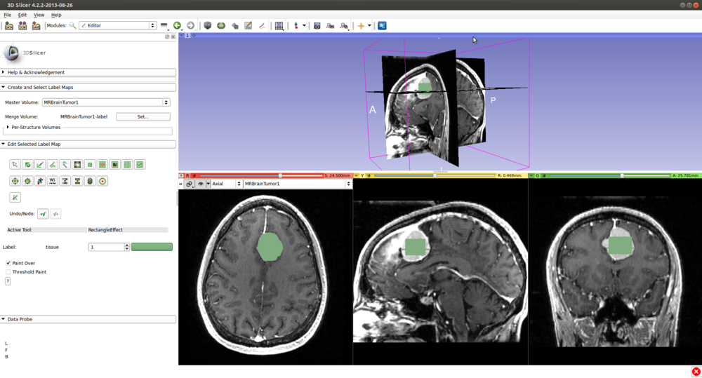 Documentation/Nightly/Modules/KSliceInteractiveSegmenter - Slicer Wiki