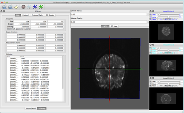Documentation/4.3/Training - Slicer Wiki
