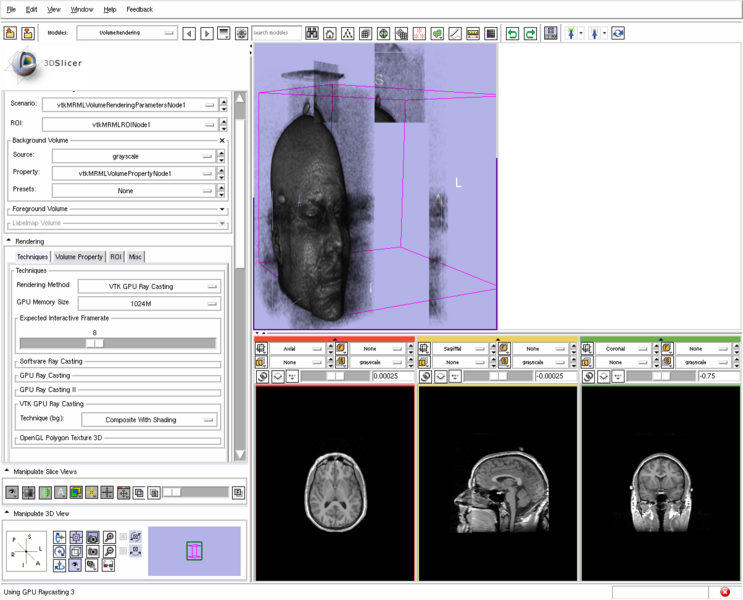 File:VtkGPURayCasting-DualView.png