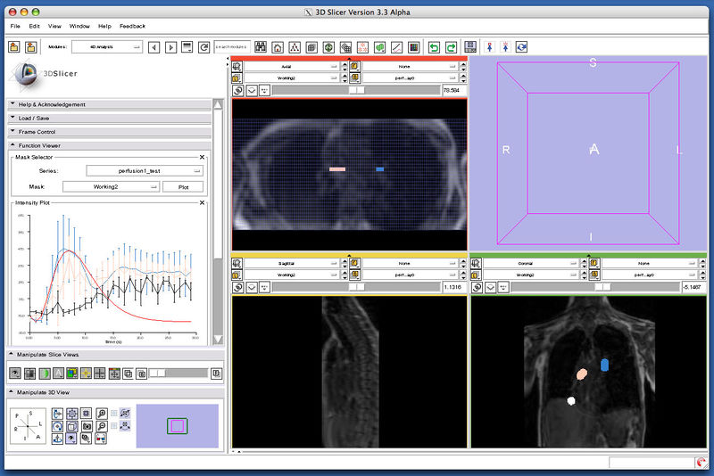 File:3DSlicerFourDAnalysis Screenshot.png