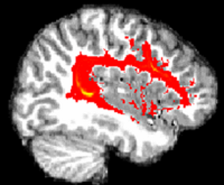 File:Knaus-BrainLang2010-fig2.png