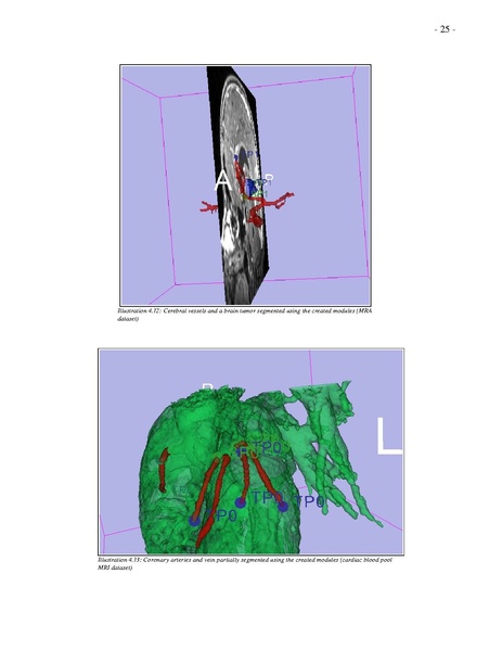File:Haehn-Slicer VMTK student research project.pdf