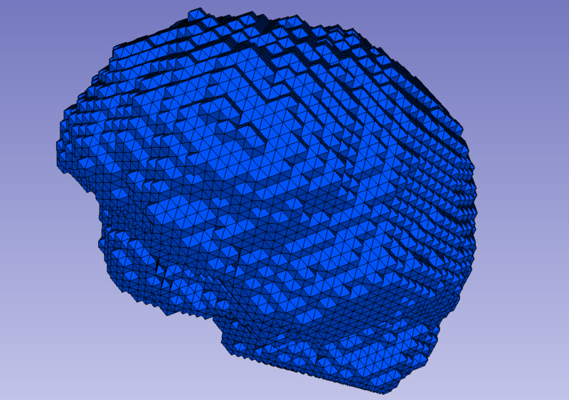 File:Brain before.jpg