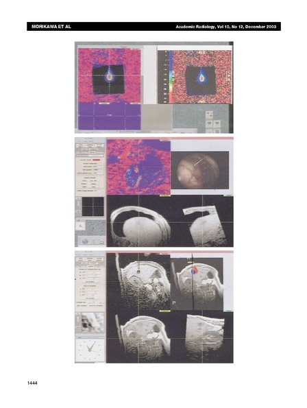 File:Morikawa-AcadRadiol2003.pdf