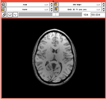 EmSegment PETCT 1.png