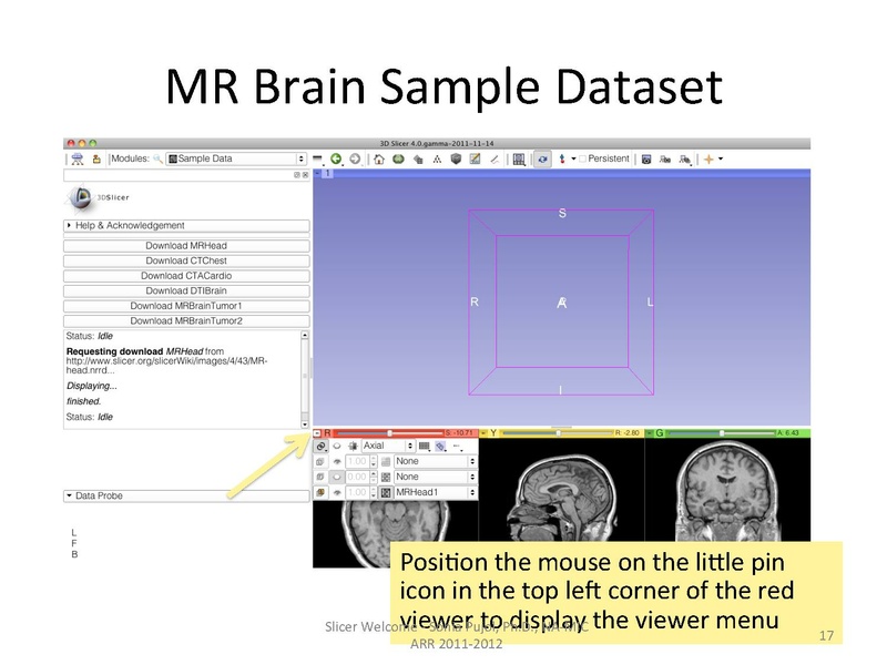File:SlicerWelcome-tutorial SoniaPujol.pdf