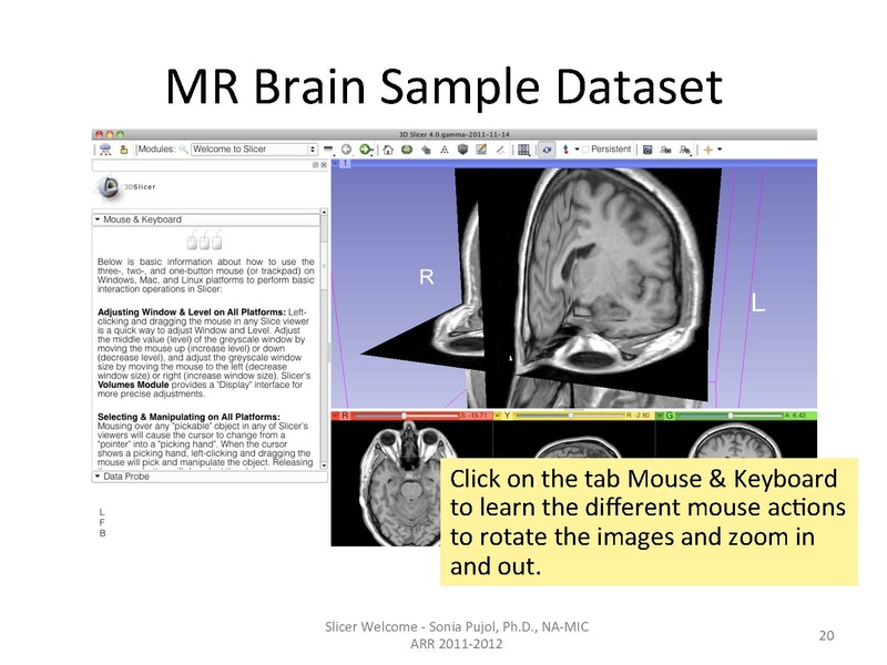 File:SlicerWelcome-tutorial SoniaPujol.pdf