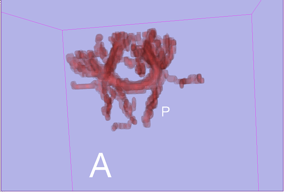 Modules:StochasticTractography-Documentation-3.6 - Slicer Wiki