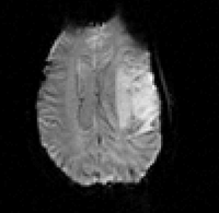 RegLib C09: fMRI to T1