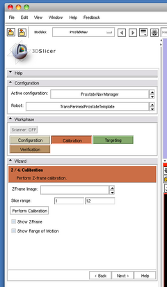 Slicer3 ProstateNav OpenCalibration.png