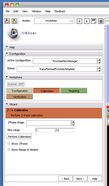 File:Slicer3 ProstateNav OpenCalibration.png