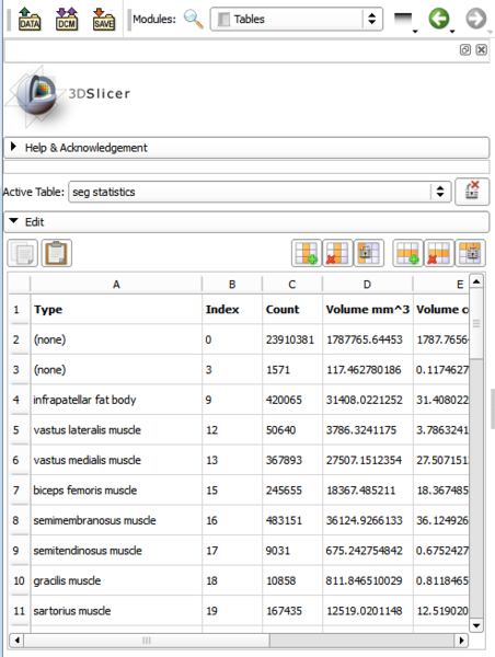File:Slicer45-Tables-GUI.png