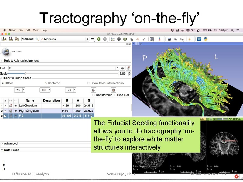 File:DiffusionMRIanalysis Tutorial Slicer4.5 SoniaPujol.pdf