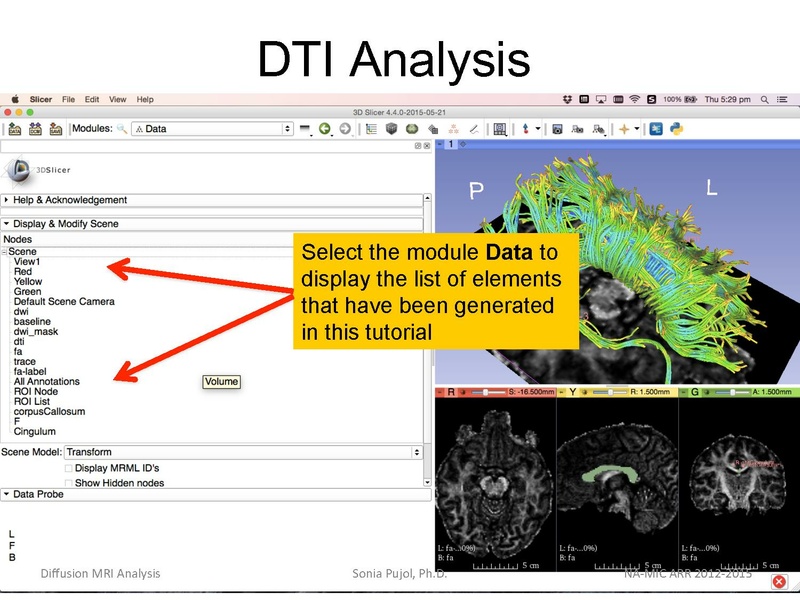 File:DiffusionMRIanalysis Tutorial Slicer4.5 SoniaPujol.pdf