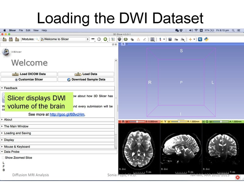 File:DiffusionMRIanalysis Tutorial Slicer4.5 SoniaPujol.pdf