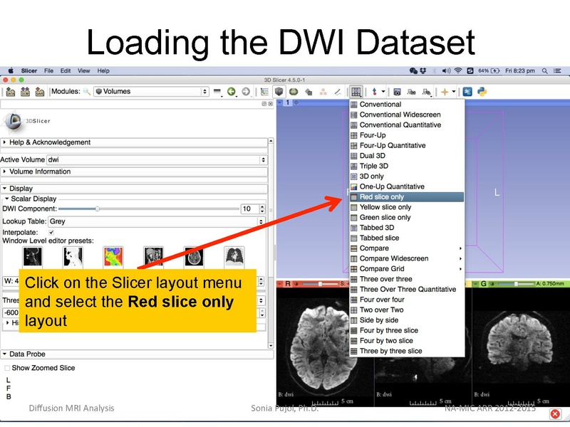 File:DiffusionMRIanalysis Tutorial Slicer4.5 SoniaPujol.pdf