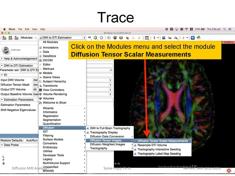 File:DiffusionMRIanalysis Tutorial Slicer4.5 SoniaPujol.pdf